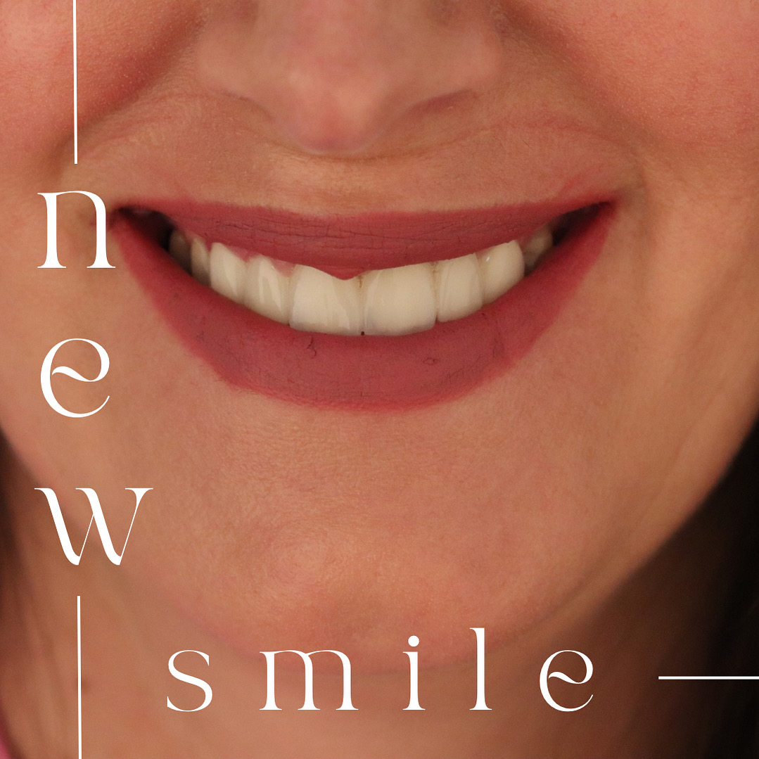 Bezbolne intervencije - Stomatološka ordinacija ProDent